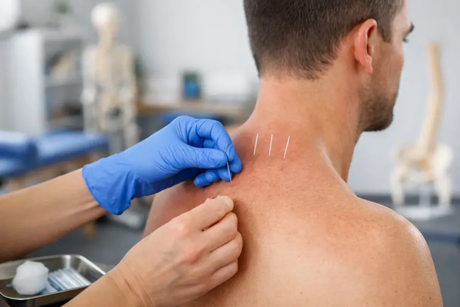 Dry Needling — Ξηρά Βελόνα